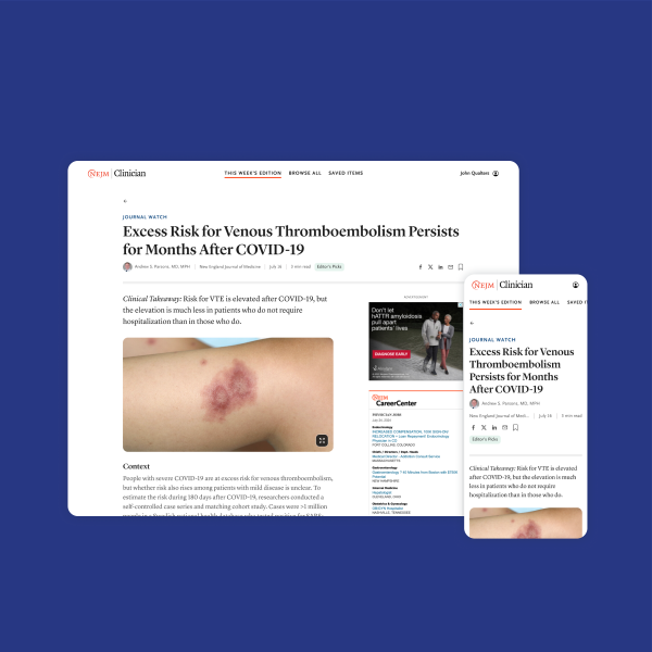 Image of article templates in desktop and mobile